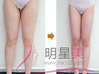 最有效<a href=http://www.sbs17.com/listinfo-684-0.html target=_blank class=infotextkey>瘦大腿</a>內(nèi)側(cè)