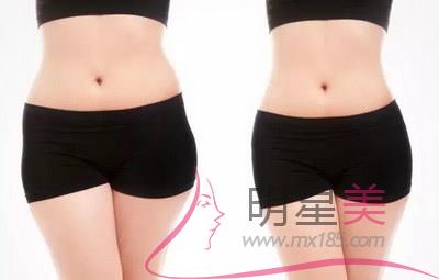 打<a href=http://www.sbs17.com/listinfo-631-0.html target=_blank class=infotextkey>瘦臉</a>針臉會腫多久