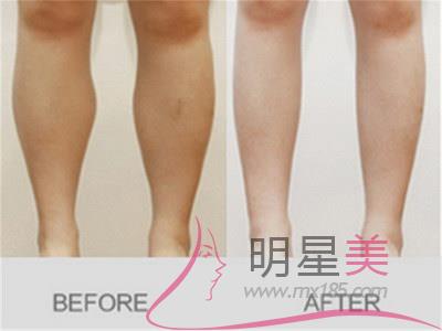 怎樣<a href=http://www.sbs17.com/listinfo-684-0.html target=_blank class=infotextkey>瘦大腿</a>小腿和臀部