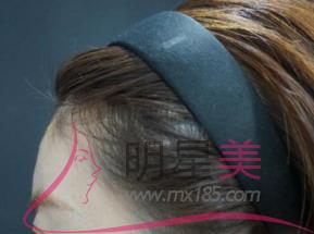 <a href=http://www.sbs17.com/listinfo-630-0.html target=_blank class=infotextkey>豐太陽(yáng)穴</a>的收費(fèi)
