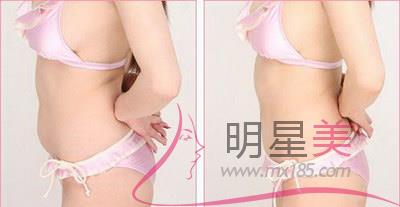 哪家超聲<a href=http://www.sbs17.com/listinfo-682-0.html target=_blank class=infotextkey>溶脂</a>好