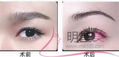 紋眉一個(gè)星期能不能敷面膜