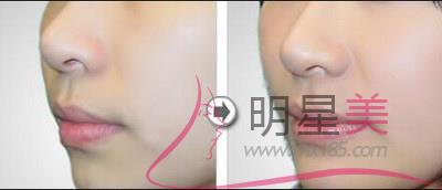 <a href=http://www.sbs17.com/listinfo-643-0.html target=_blank class=infotextkey>豐額頭</a>用什么材料