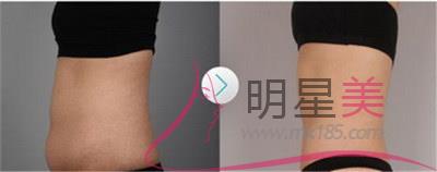 怎么來減肚子上的贅肉