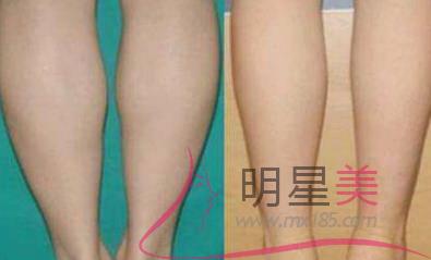 白醋泡姜能<a href=http://www.sbs17.com/listinfo-687-0.html target=_blank class=infotextkey>減肥</a>嗎