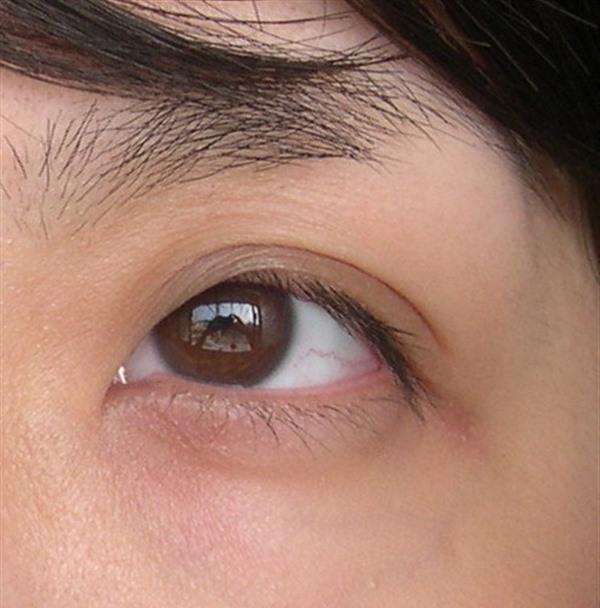 <a href=http://www.sbs17.com/listinfo-782-0.html target=_blank class=infotextkey>去眼角細紋</a>失敗修復價格