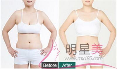 怎么樣<a href=http://www.sbs17.com/listinfo-674-0.html target=_blank class=infotextkey>瘦腰</a>提臀