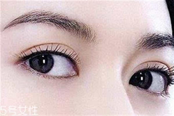 割<a href=http://www.sbs17.com/listinfo-724-0.html target=_blank class=infotextkey>雙眼皮</a>眼睛腫怎么辦？疤克可以預(yù)防疤痕增生