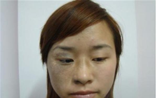 做<a href=http://www.sbs17.com/listinfo-799-0.html target=_blank class=infotextkey>去太田痣</a>價(jià)格多少錢