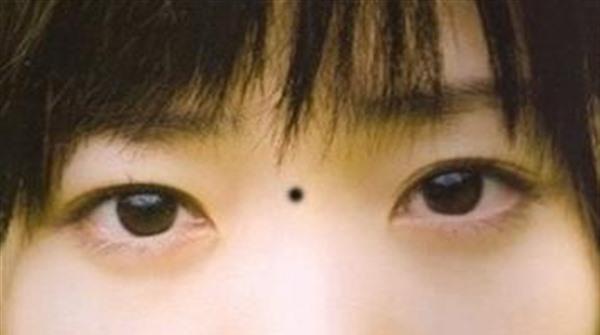 微晶磨削點(diǎn)痣價(jià)格多少錢(qián)