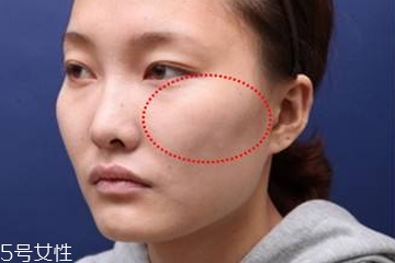 <a href=http://www.sbs17.com/listinfo-646-0.html target=_blank class=infotextkey>顴骨墊高</a>手術(shù)多久能恢復(fù) <a href=http://www.sbs17.com/listinfo-646-0.html target=_blank class=infotextkey>顴骨墊高</a>多久能看到完整效果
