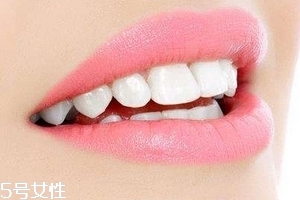超聲波潔牙牙齒會變白嗎？超聲波潔牙心得