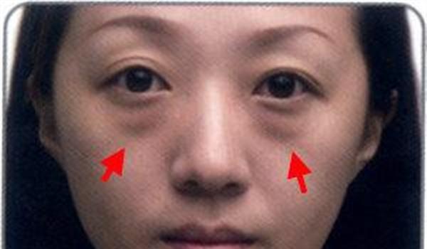 做微晶磨皮<a href=http://www.sbs17.com/listinfo-782-0.html target=_blank class=infotextkey>去眼角細(xì)紋</a>風(fēng)險有哪些