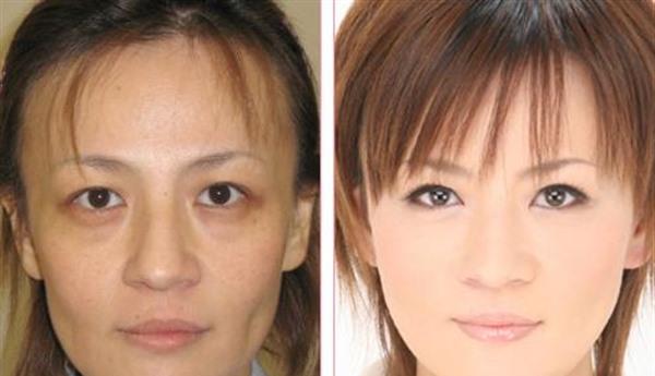 RV極速美塑美膚價格要多少？
