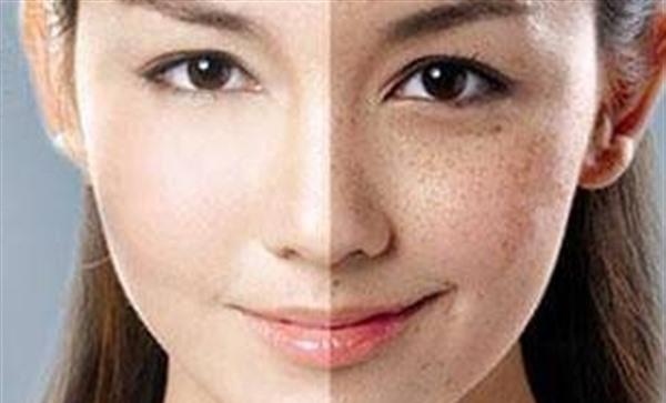 夏天有什么<a href=http://www.sbs17.com/listinfo-795-0.html target=_blank class=infotextkey>祛斑</a>的方法