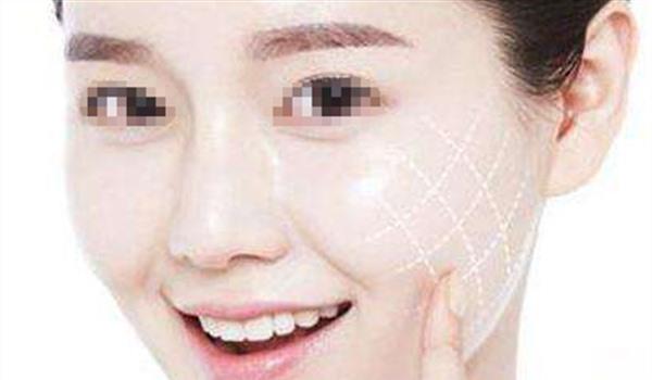 上海哪家醫(yī)院做埋線提升好？