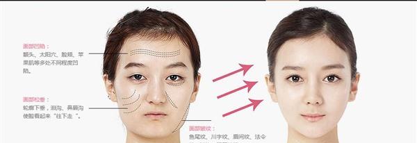 <a href=http://www.sbs17.com/listinfo-764-0.html target=_blank class=infotextkey>面部年輕化</a>價(jià)格