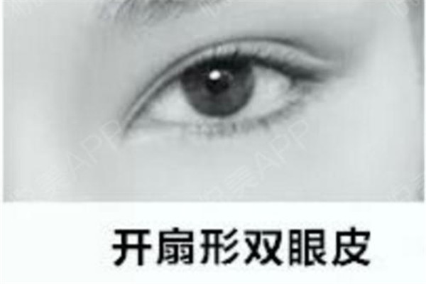 做<a href=http://www.sbs17.com/listinfo-724-0.html target=_blank class=infotextkey>雙眼皮</a>可以不開刀嗎 不開刀可以做<a href=http://www.sbs17.com/listinfo-724-0.html target=_blank class=infotextkey>雙眼皮</a>嗎