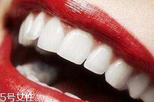 冷光美白會反彈嗎？冷光美白心得