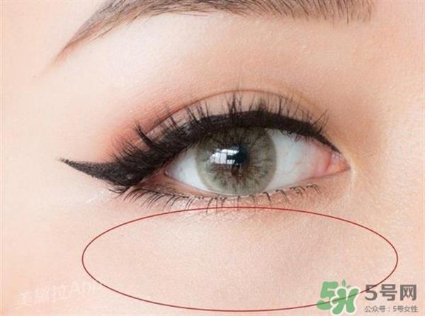 <a href=http://www.sbs17.com/listinfo-731-0.html target=_blank class=infotextkey>玻尿酸</a>填充淚溝多久恢復自然？<a href=http://www.sbs17.com/listinfo-731-0.html target=_blank class=infotextkey>玻尿酸</a>填充淚溝的危害