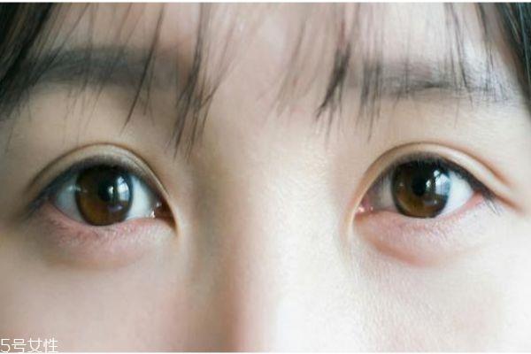 <a href=http://www.sbs17.com/listinfo-705-0.html target=_blank class=infotextkey>美瞳線</a>有沒必要紋 紋<a href=http://www.sbs17.com/listinfo-705-0.html target=_blank class=infotextkey>美瞳線</a>注意事項(xiàng)