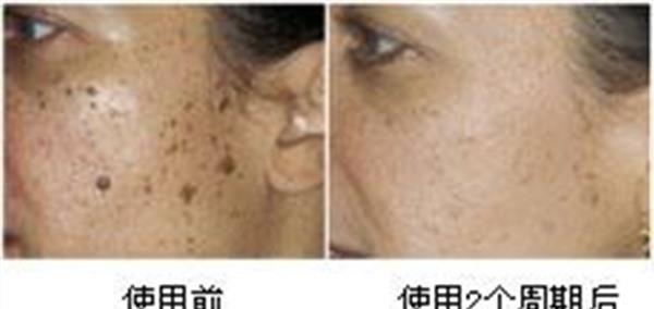 做<a href=http://www.sbs17.com/listinfo-788-0.html target=_blank class=infotextkey>去黑痣</a>失敗修復(fù)多少錢