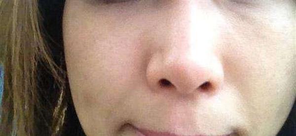 做彩光<a href=http://www.sbs17.com/listinfo-795-0.html target=_blank class=infotextkey>祛斑</a>風險有哪些