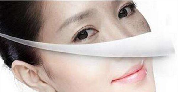 做E光<a href=http://www.sbs17.com/listinfo-786-0.html target=_blank class=infotextkey>去黃褐斑</a>風(fēng)險有哪些