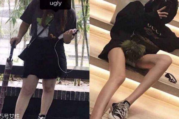 瘦腿針可以反復打嗎 打瘦腿針小腿可以瘦多少厘米