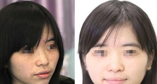 做彩光<a href=http://www.sbs17.com/listinfo-795-0.html target=_blank class=infotextkey>祛斑</a>副作用是什么