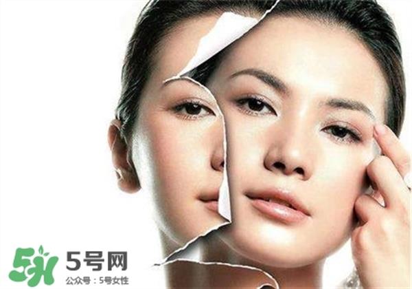 美白養(yǎng)護(hù)是什么？美白養(yǎng)護(hù)可以連續(xù)打嗎？
