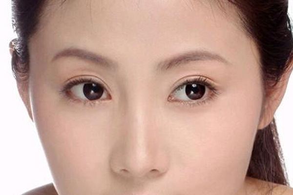 做<a href=http://www.sbs17.com/listinfo-724-0.html target=_blank class=infotextkey>雙眼皮</a>重瞼術(shù)有什么危害 重瞼術(shù)有哪些治療方法