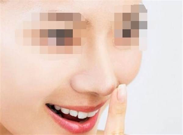 自體脂肪<a href=http://www.sbs17.com/listinfo-737-0.html target=_blank class=infotextkey>隆鼻</a>的缺點(diǎn)有哪些