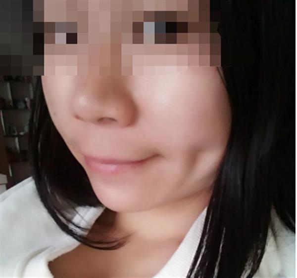 <a href=http://www.sbs17.com/listinfo-637-0.html target=_blank class=infotextkey>酒窩整形</a>多少錢術(shù)后如何護(hù)理