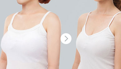 <a href=http://www.sbs17.com/listinfo-617-0.html target=_blank class=infotextkey>巨乳縮小</a>術(shù)的護(hù)理要點(diǎn)