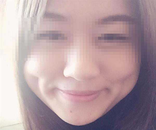 <a href=http://www.sbs17.com/listinfo-637-0.html target=_blank class=infotextkey>酒窩整形</a>多少錢及術后護理