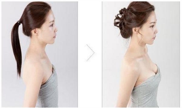韓式注射<a href=http://www.sbs17.com/listinfo-618-0.html target=_blank class=infotextkey>隆胸</a>怎么樣