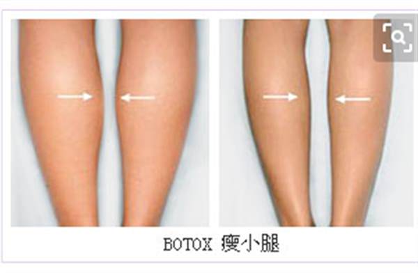 怎樣<a href=http://www.sbs17.com/listinfo-679-0.html target=_blank class=infotextkey>瘦小腿</a>有效