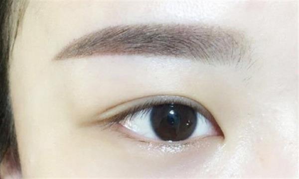 眼袋抽脂眼袋抽脂術(shù)多少錢