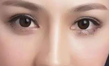 懷孕后能帶美瞳嗎