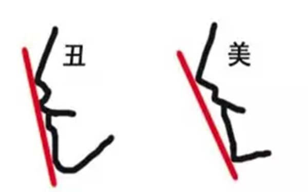 <a href=http://www.sbs17.com/listinfo-754-0.html target=_blank class=infotextkey>鼻翼</a>縮小術(shù)是長期的嗎