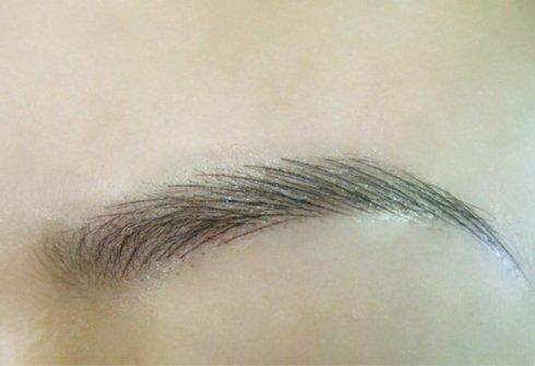 提眉手術(shù)的價(jià)格是多少