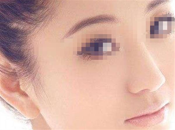 解析光子<a href=http://www.sbs17.com/listinfo-770-0.html target=_blank class=infotextkey>嫩膚</a>術(shù)