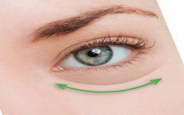 內(nèi)吸<a href=http://www.sbs17.com/listinfo-708-0.html target=_blank class=infotextkey>去眼袋</a>多久能恢復(fù)?