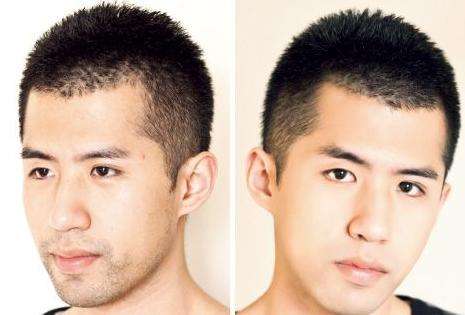 男士胡子可以<a href=http://www.sbs17.com/listinfo-670-0.html target=_blank class=infotextkey>脫毛</a>嗎