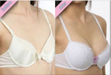 假體<a href=http://www.sbs17.com/listinfo-618-0.html target=_blank class=infotextkey>隆胸</a>后影響懷孕嗎