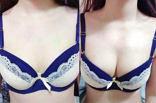 硅膠假體<a href=http://www.sbs17.com/listinfo-618-0.html target=_blank class=infotextkey>隆胸</a>有哪些特點(diǎn)