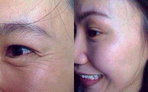 botox<a href=http://www.sbs17.com/listinfo-614-0.html target=_blank class=infotextkey>除皺</a>瘦型素<a href=http://www.sbs17.com/listinfo-614-0.html target=_blank class=infotextkey>除皺</a>瘦型素注射<a href=http://www.sbs17.com/listinfo-614-0.html target=_blank class=infotextkey>除皺</a>價格是多少錢