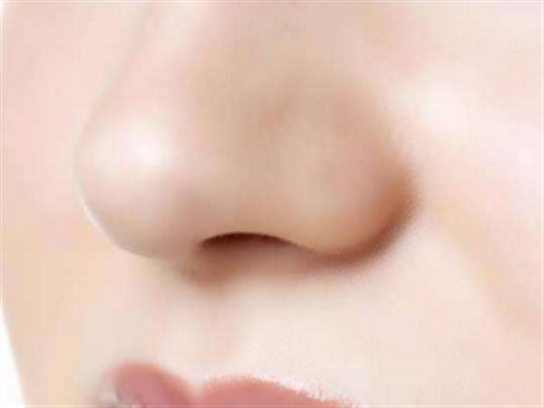 透明質(zhì)酸注射<a href=http://www.sbs17.com/listinfo-737-0.html target=_blank class=infotextkey>隆鼻</a>術(shù)后變寬該補(bǔ)救