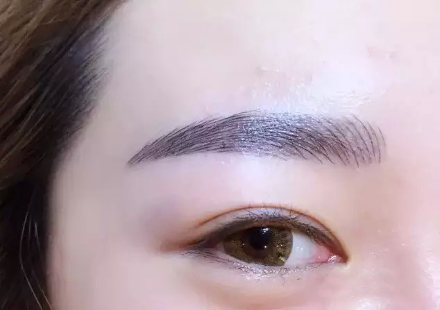 紋眉后需要注意什么